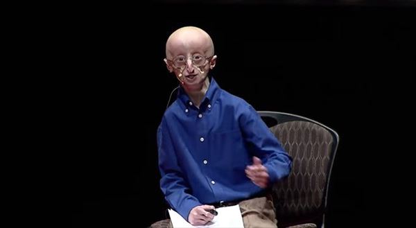 17歳で”老衰死”した早老症の少年が遺した、幸せに生きるための3つの哲学