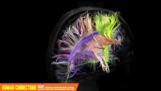 人間の脳の地図「ヒト・コネクトーム」が科学を変える？ ログミー